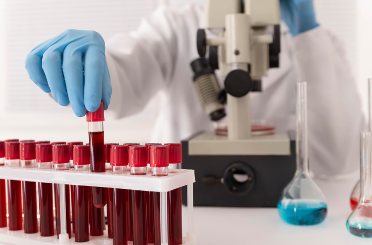 Blood Tests for Ulcerative colitis