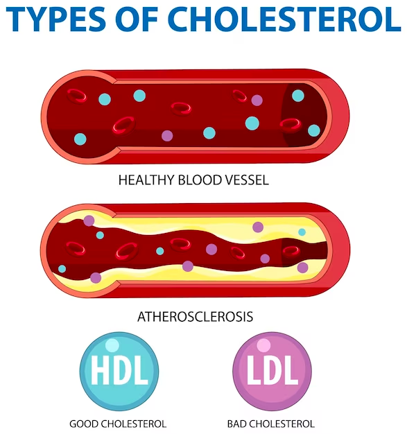 Cholesterol